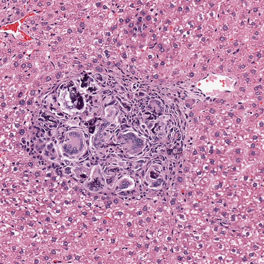 H&E rat liver, 20x, focal granuloma under review