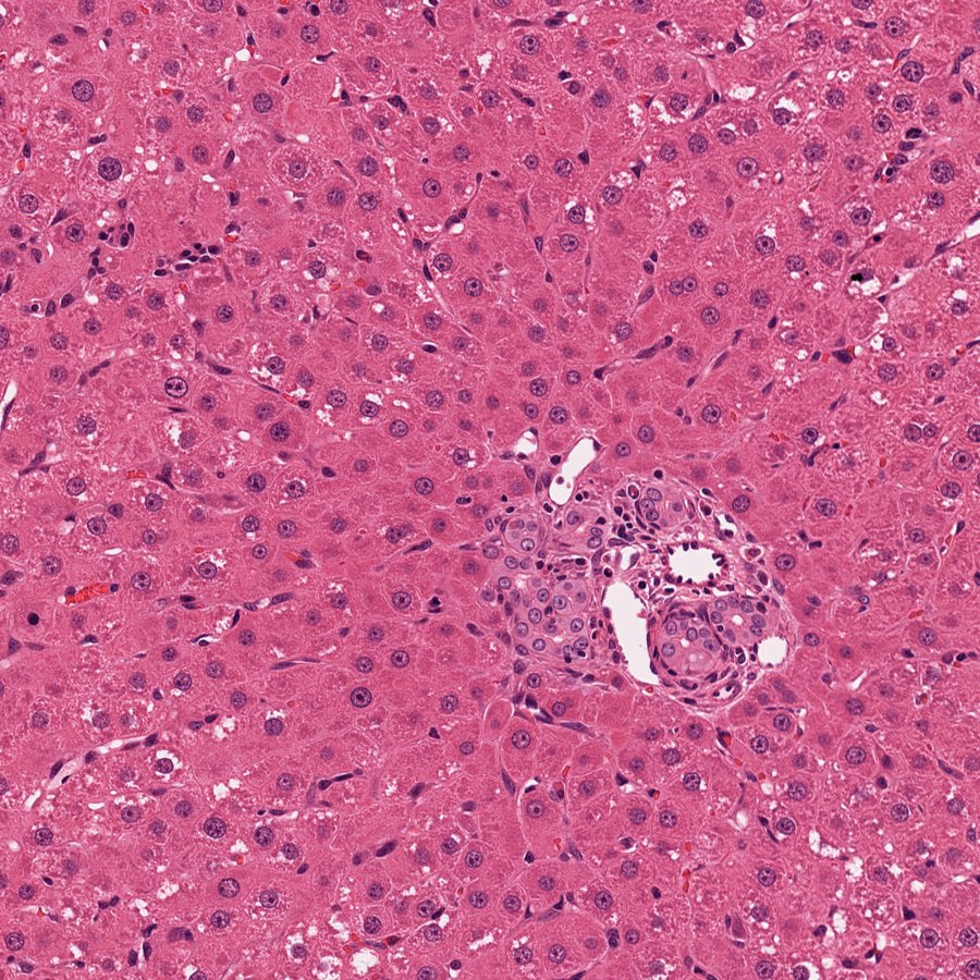 H&E rat liver, 20x, bile duct hyperplasia and hepatocellular hypertrophy