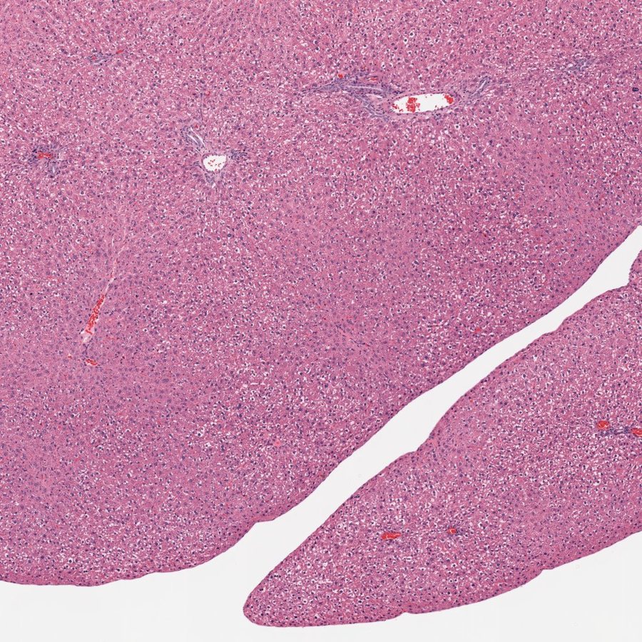 Control liver, H&E