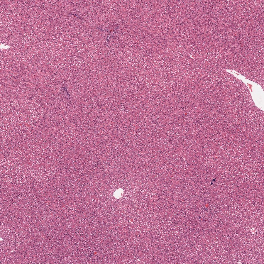 30 mg/kg liver, H&E