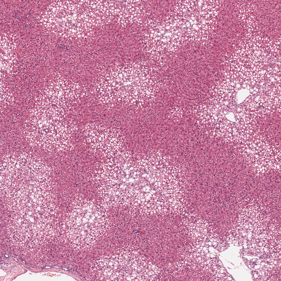 300 mg/kg liver, H&E